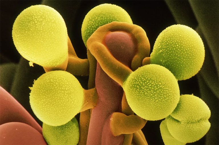 罌粟花粉粒.jpg 罌粟花粉粒